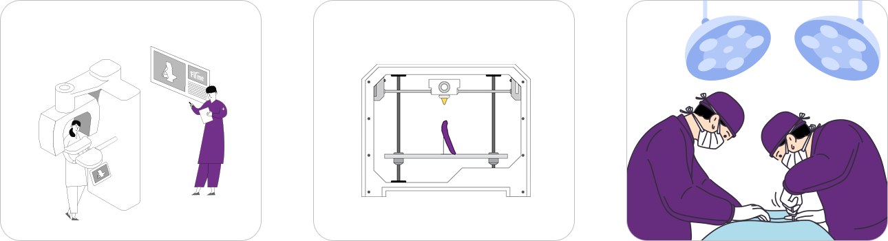 FITme implant process: CT scan and analysis, 3D printing, simulation and surgery
