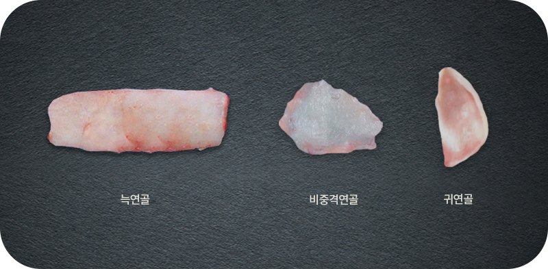 늑연골, 비중격연골, 귀연골