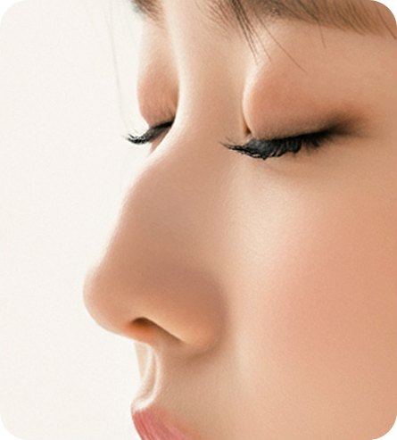 코재건술 CASE 06 — 다시 매부리가 생긴 경우