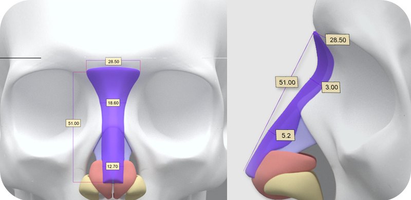 3D 맞춤 보형물 설계 치수(길이 51.00mm 등)